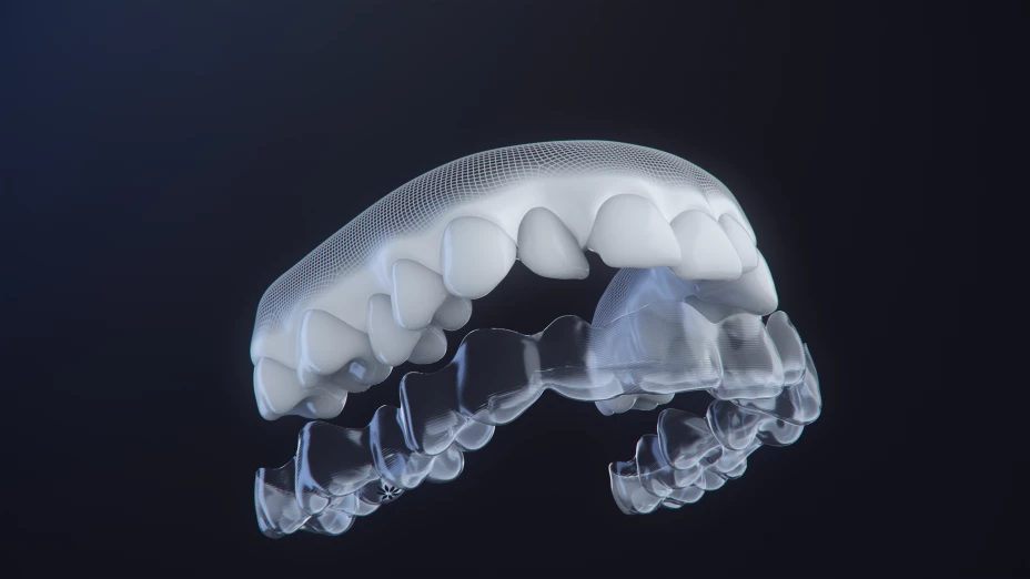 Alineador digital.jpg