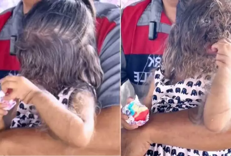 Niña con cabello en el rostro causa revuelo en TikTok; ¿cuál es su condición?