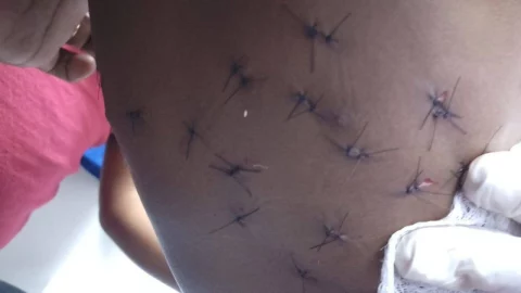 Hombre ataca a su hija