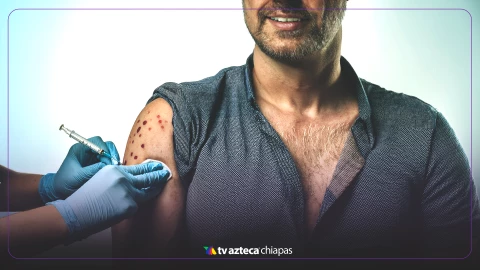 Casos confirmados de sarampión en México en 2025: Chihuahua es el estado con mayor casos