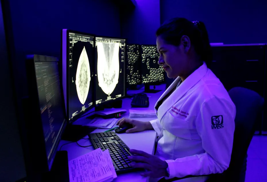 Cáncer de mama imss .jpg