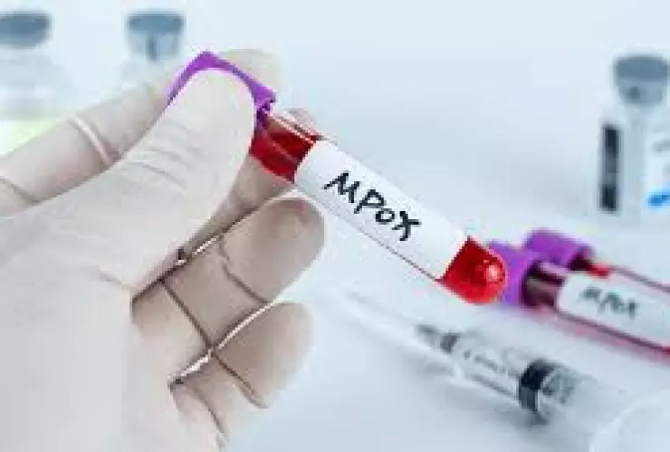 Esto sabemos sobre la NUEVA VARIANTE de mpox, la variante detectada en África