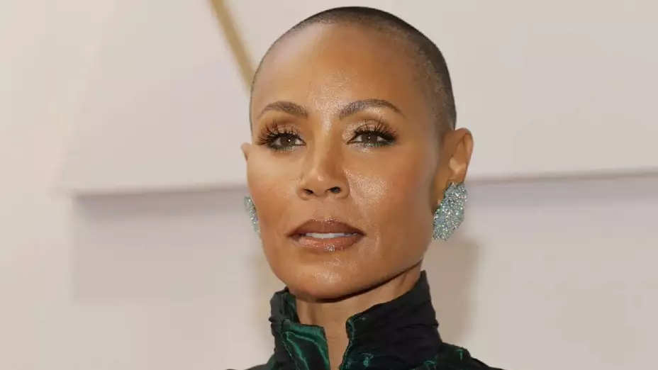 alopecia enfermedad que sufre Jada Pinkett Smith