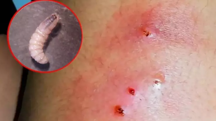 ¡ATENCIÓN! Suman MÁS casos del gusano barrenador en humanos ¿Son de Yucatán_