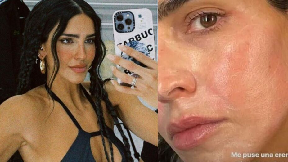 que le paso a barbara de regil en la cara