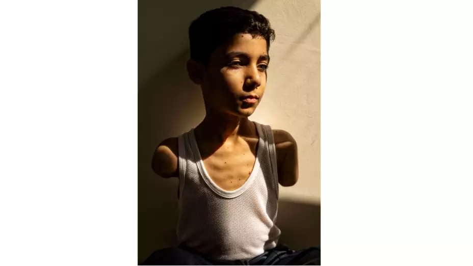 Mahmoud Ajjour, un niño que perdió los brazos tras un ataque israelí en Gaza.