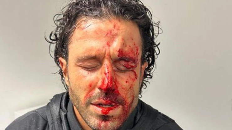 Fabio Grosso Marsella vs Lyon