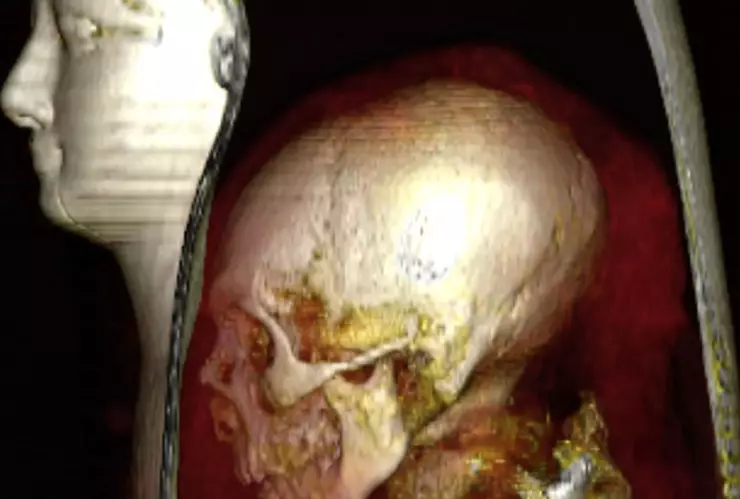 arqueologos momia faraon amenhotep