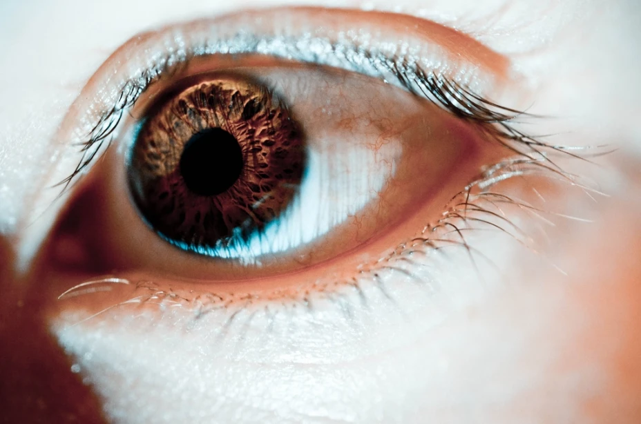 Glaucoma