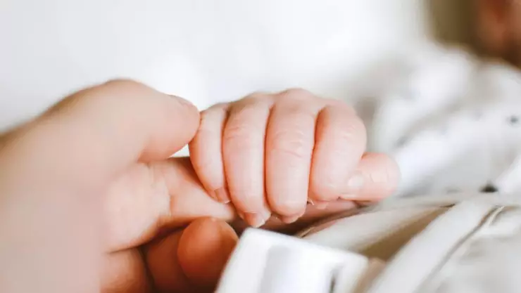 bebe sindrome de down.