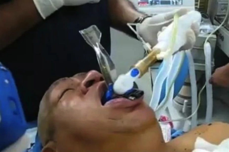 La supuesta foto de Hugo Chávez