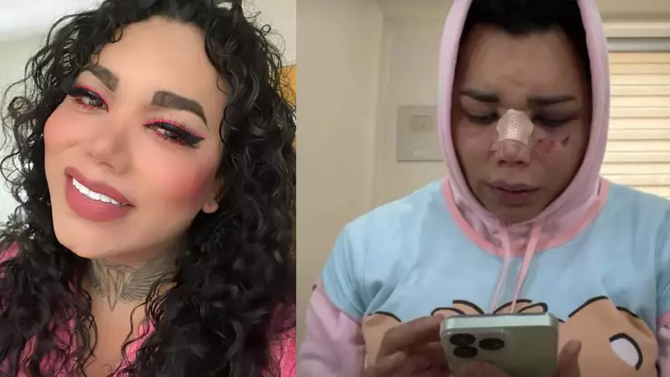 VIDEO_ Paola Suárez confiesa seguir queriendo a su prometido pese a la golpiza que le dio