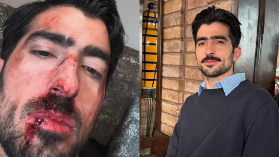 Jezzini comparte foto con golpes y preocupa a seguidores_ ¿Qué le pasó realmente al influencer_.jpg