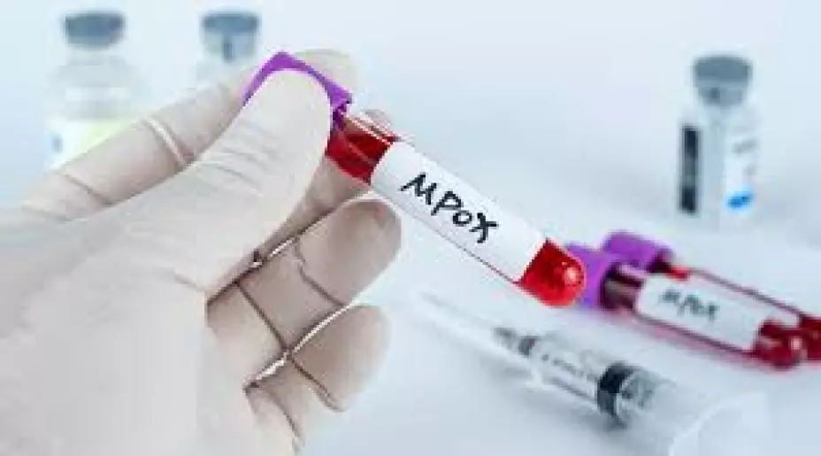 Esto sabemos sobre la NUEVA VARIANTE de mpox, la variante detectada en África