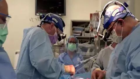 Trasplantan corazones de cerdo en Nueva York