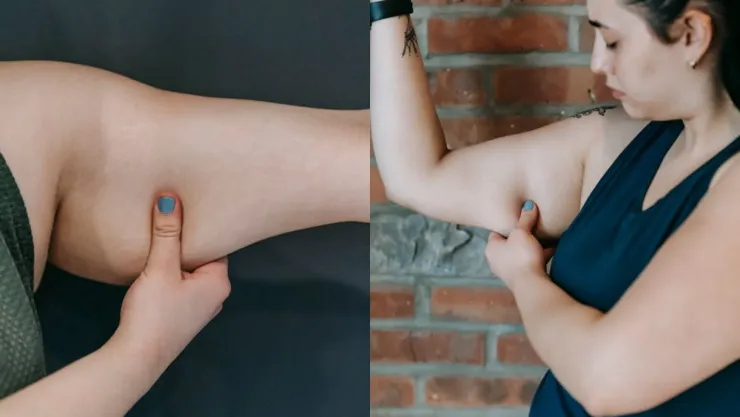 7 consejos de moda y estilo para brazos con alas de murciélago
