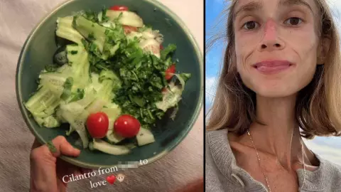 joven fallece por desnutrición