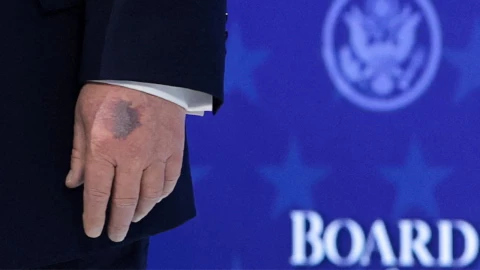 La mano magullada del presidente de Estados Unidos , Donald Trump , mientras asiste a un anuncio de la carta constitutiva de su iniciativa Junta de Paz destinada a resolver conflictos globales, junto con el 56º Foro Económico Mundial anual (FEM), en Davos, Suiza, el 22 de enero de 2026.