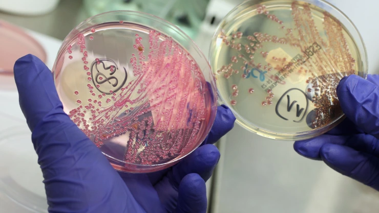 Health Authorities Seek Clues To EHEC Outbreak