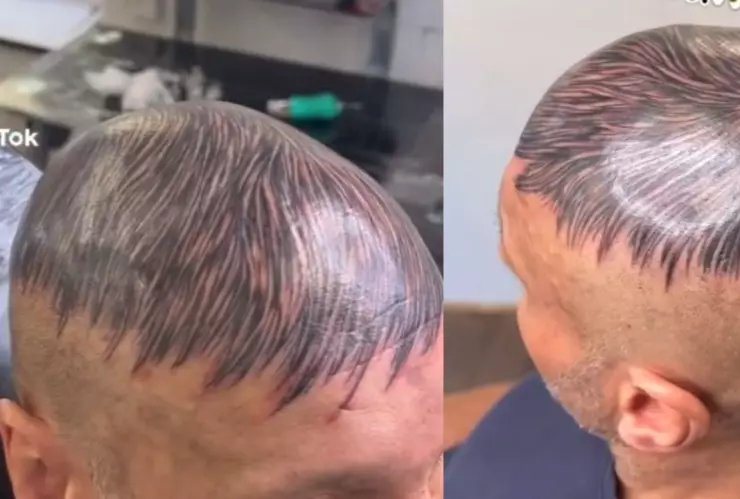 Hombre se viraliza por truco para disimular calvicie