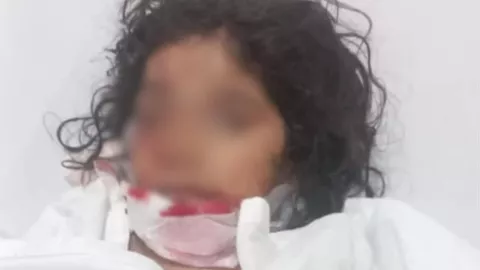 Niña de dos años atacada por perro en Mazatlán