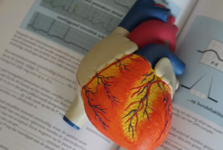 ¿Qué es el infarto al miocardio? La causa de la muerte de Julian Figueroa