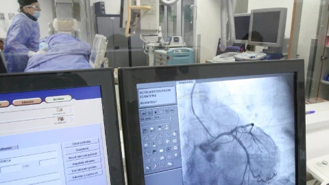 cateterismo cardiaco qué es procedimiento