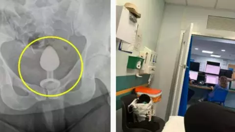 Juguete íntimo alojado en mujer