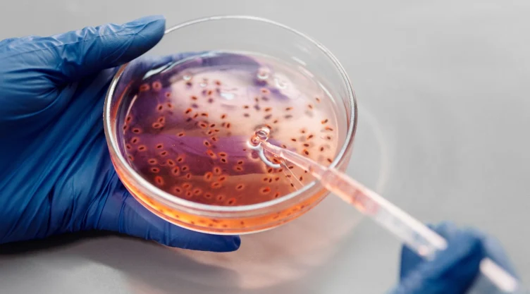 vibrio-vulnificus-bacteria-come-carne