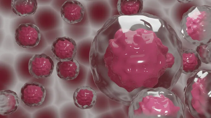 Revelan que menores de 50 años tiene mayor probabilidad de desarrollar cáncer