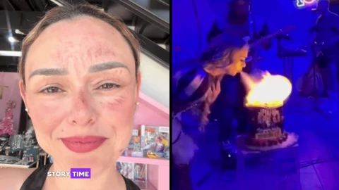 Así quedó el rostro de la influencer que se quemó por hacer un trend viral.png