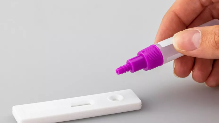 Detectan 9,046 nuevos casos de VIH en México; Jalisco es de los estados con más contagios