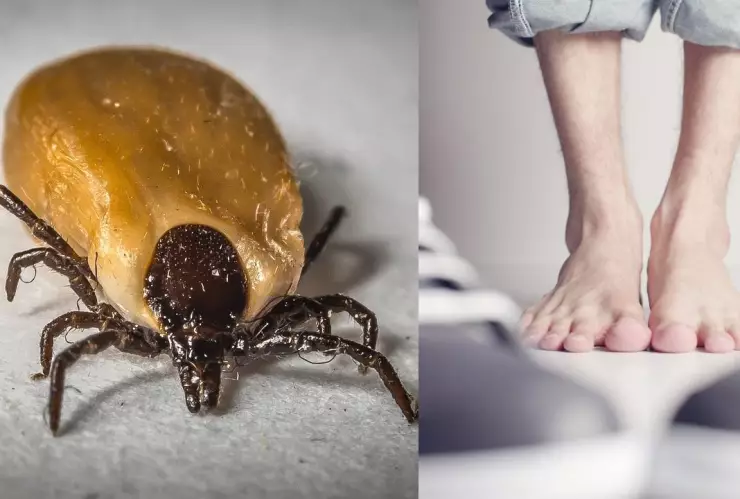 Le amputan todos los dedos del pie por picadura de garrapata