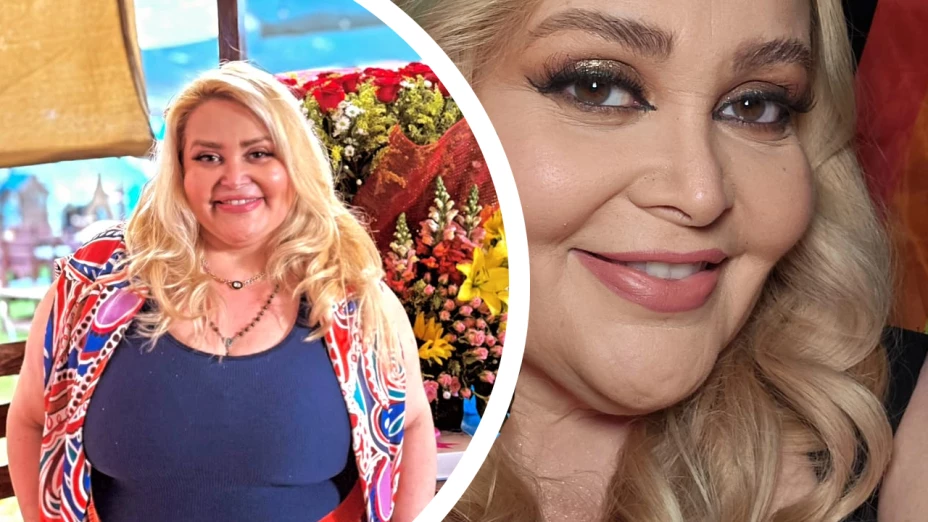 Sheyla Tadeo pierde 58 kg y dona su piel a niños con quemaduras graves
