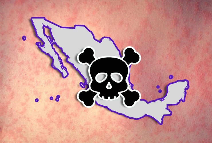 Confirman primera muerte por sarampión en México de 2026; ya son más de 7 mil contagios y estos son los estados afectados.webp