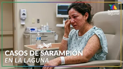 Sarampión La Laguna: número casos HOY 27 febrero 2026