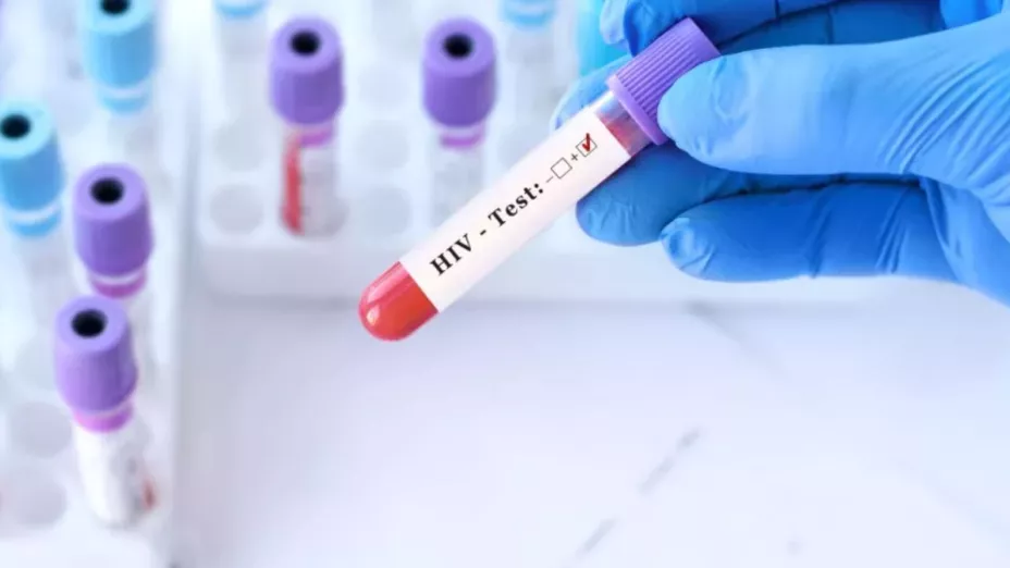 Aumentan casos de VIH/SIDA en en regiones clave de Puebla este 2025; Tehuacán encabeza registro