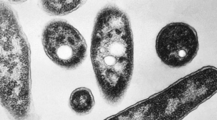 Brote de legionella en Estados Unidos