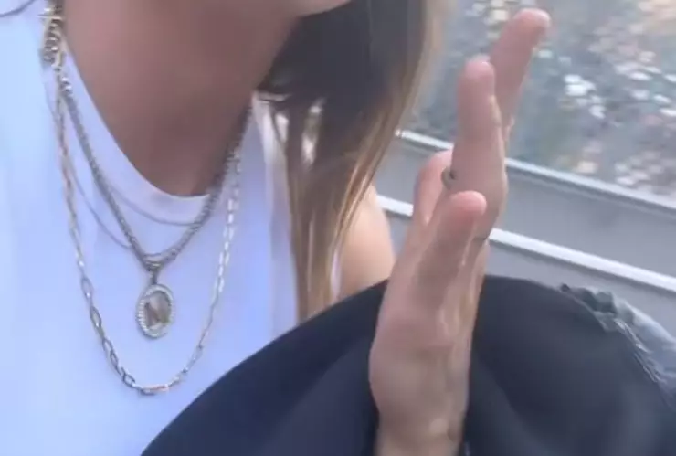 Mati Álvarez deicidó acudir a revisión por una lesión en su dedo anular