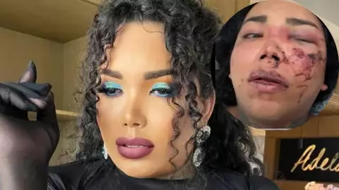 Paola Suárez de Las Perdidas está en el hospital tras recibir golpiza de su novio.jpg