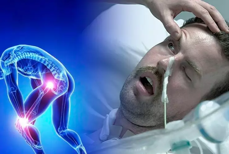 Síndrome de Guillain Barré