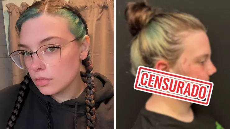 La mujer recibió atención médica tras el ataque de su mascota