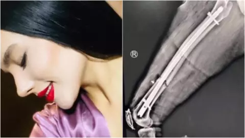 Leonor Uribe agresor Carlos Hernandez acusa ex novio lanzarla tercer piso.jpg