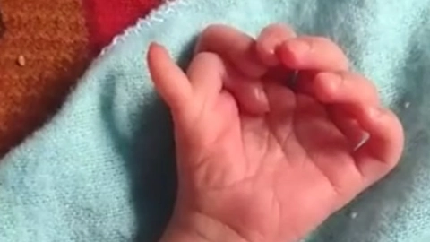 Video-nace-bebé-con-26-dedos-en-India