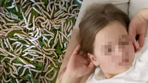 Niña tenía la cabeza infestada de gusanos por descuido de papás