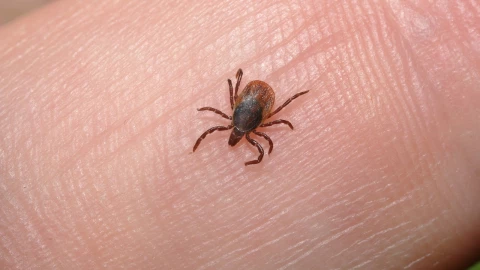 Seguidores captan piojo en la axila de actor