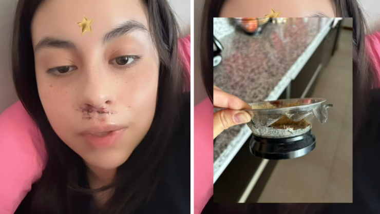 accidente licuadora.jpg