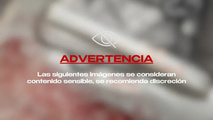 ¡IMÁGENES SENSIBLES! Balean a aficionados de futbol que viajaban en un camión tras salir de un partido