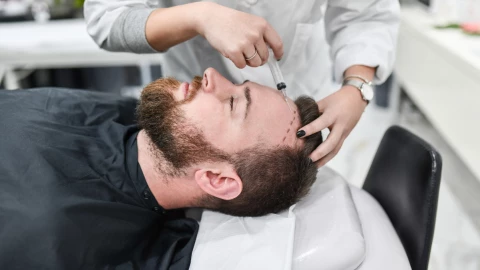 Riesgos secundarios de hacerse un trasplante capilar