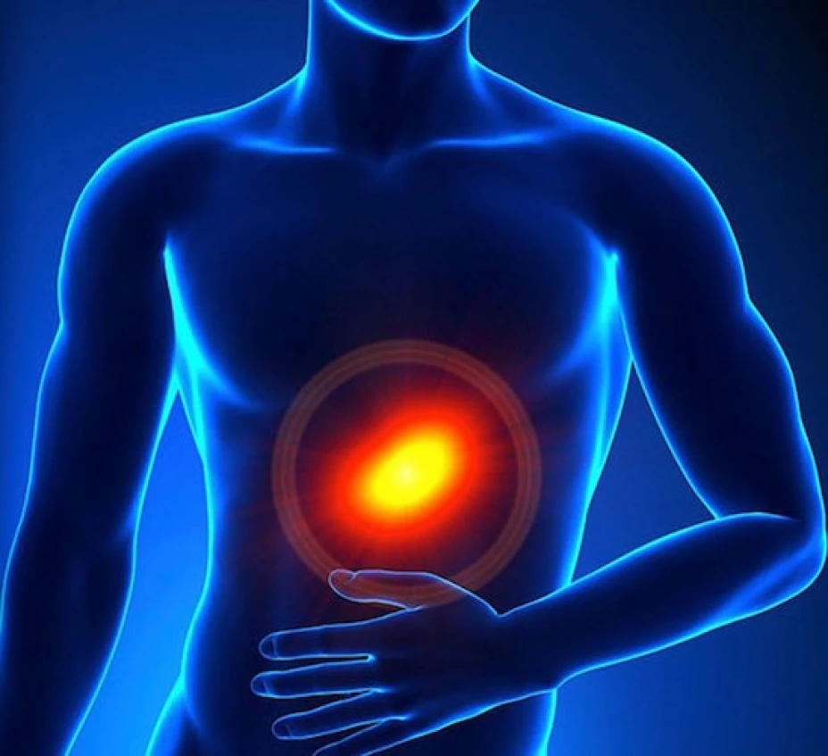 Sindrome de intestino irritable